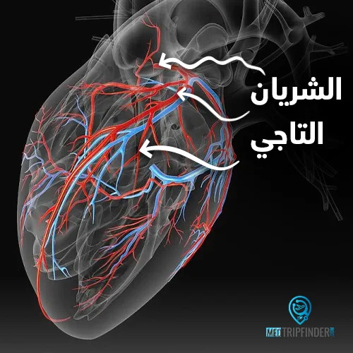 شرايين القلب التاجية